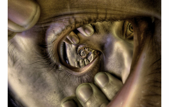 ҕX(ju) ˇg(sh) zӰ p O(sh)Ӌ(j)